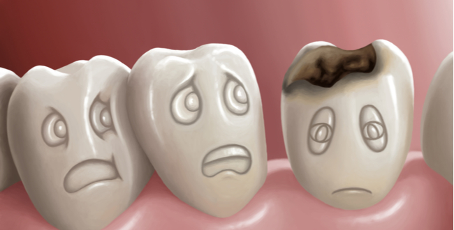 モリブデンは、虫歯予防に効果的と言われている