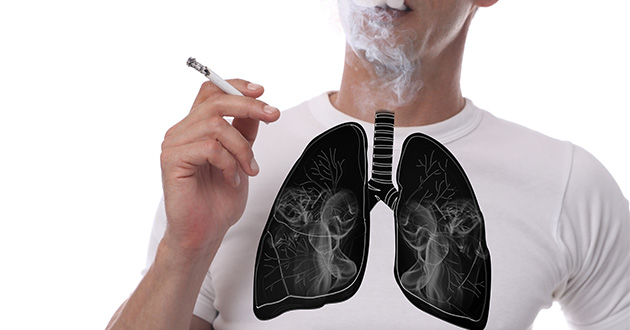 肺のお手入れが必要なのは喫煙している人